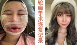 整容在线观看,揭秘美丽背后的秘密与挑战