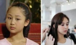 整容在线观看,揭秘美丽背后的秘密与挑战